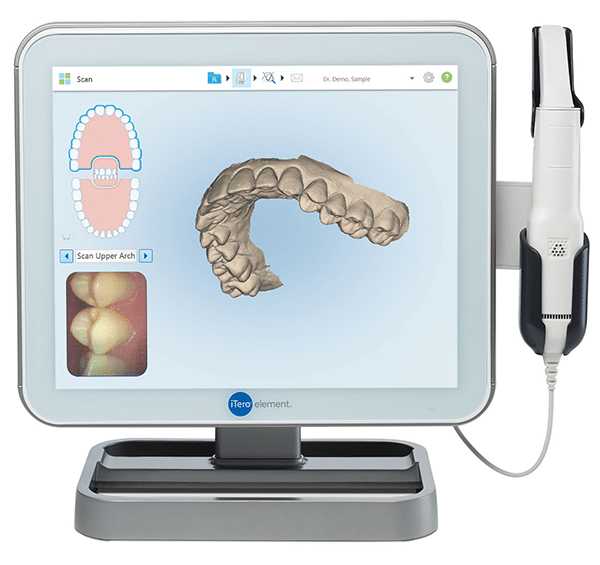 The benefits of the itero digital scanner 3 Walk in scan joosse family orthodontics