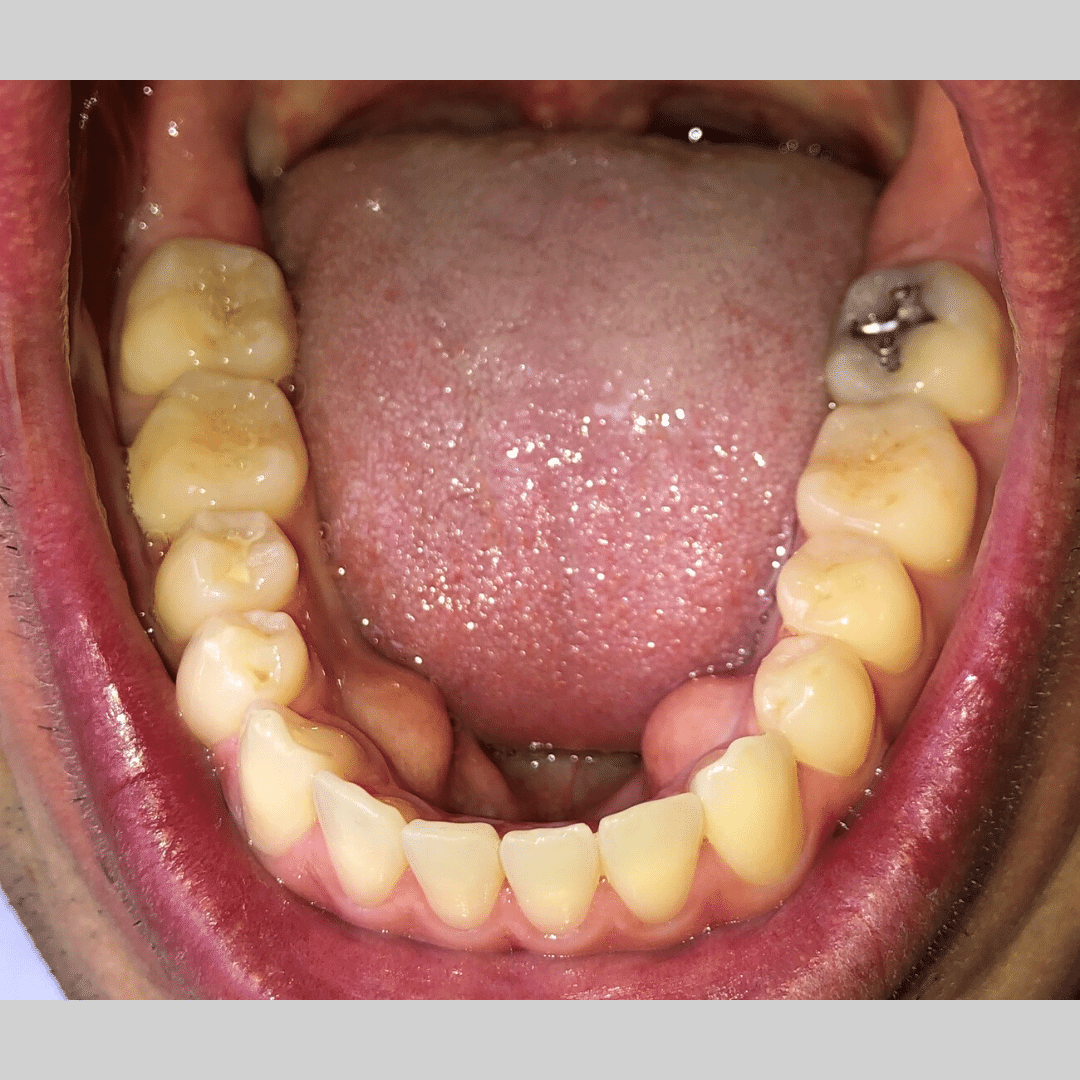 Virtual smile assessment