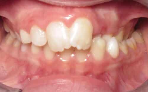 More smile transformations 150 Smile gallery jillian center start