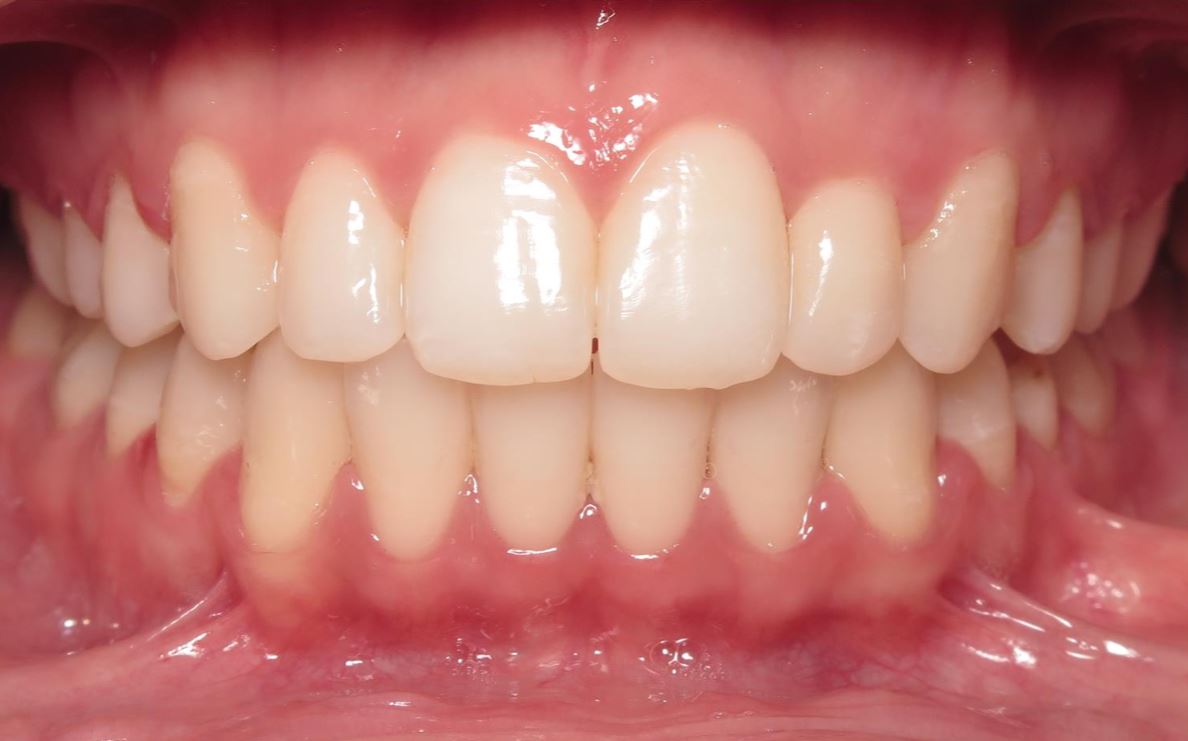 More smile transformations 159 Smile gallery melis center final