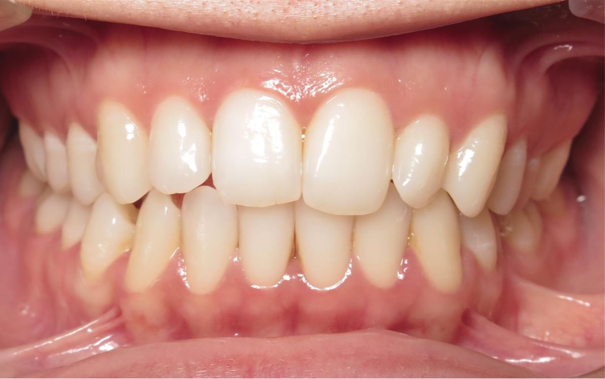 More smile transformations 158 Smile gallery melis center start