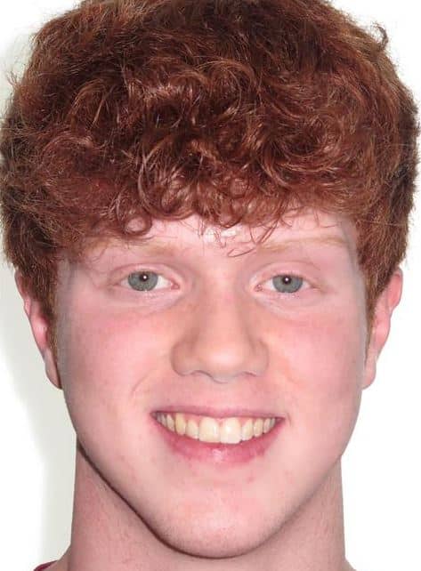More smile transformations 217 Noah patient smile finish final treatment orthodontics