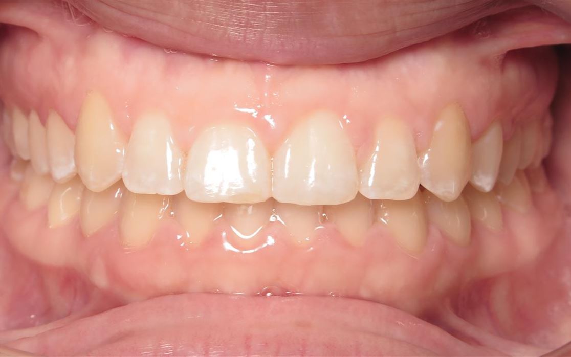 More smile transformations 213 Smile gallery octavia center final