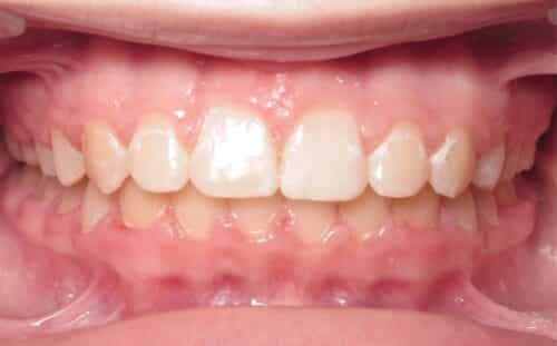 More smile transformations 241 Smile gallery sam center final