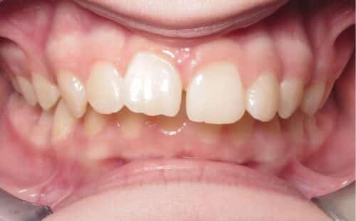 More smile transformations 240 Smile gallery sam center start
