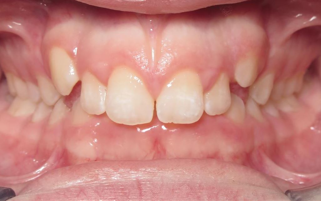 More smile transformations 198 Smile gallery taylors center start