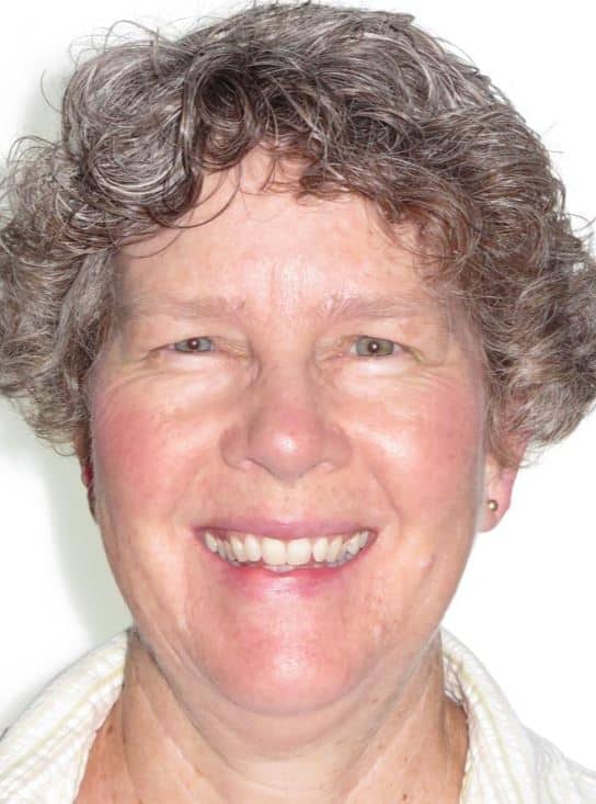 More smile transformations 184 Adult orthodontics at jfo in williamsburg va ginger smile start