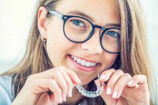 Jfo clear aligners Young woman with glasses inserting invisalign