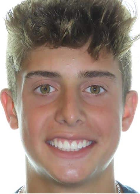 More smile transformations 163 Jfo smile gallery christiano full face final
