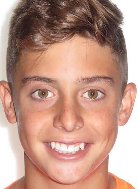 More smile transformations 162 Jfo smile gallery christiano center full face start