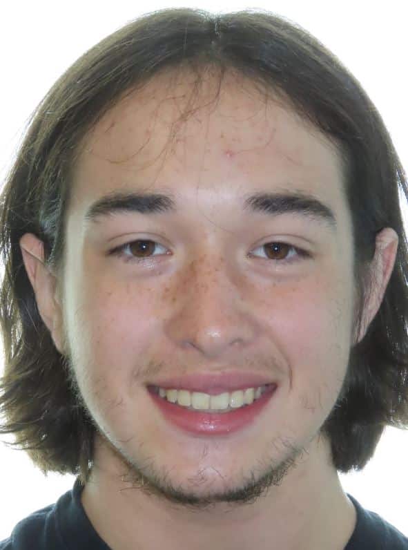 More smile transformations 145 Jfo smile gallery ethan smile final
