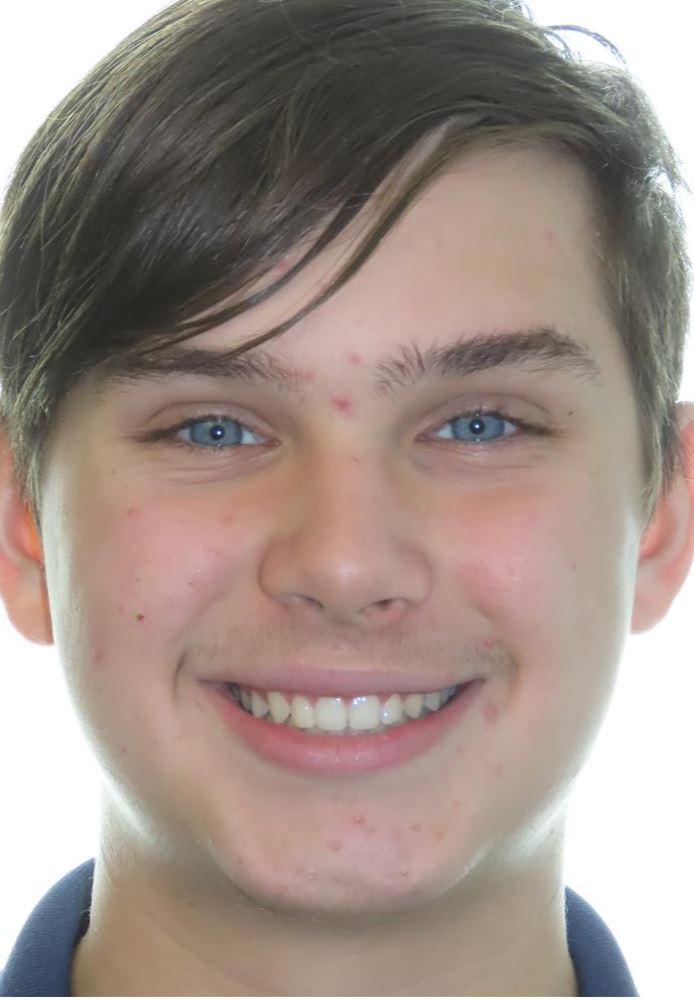 More smile transformations 131 Jfo smile gallery l smile full face finish