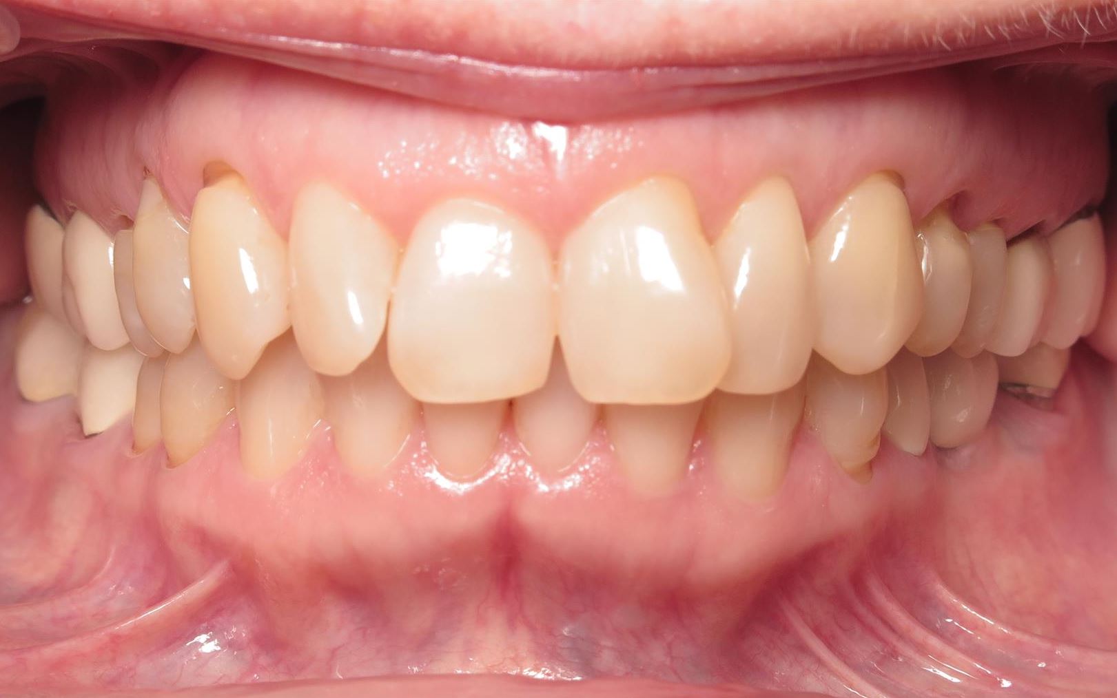 More smile transformations 140 Jfo smile gallery rc smile full face center start