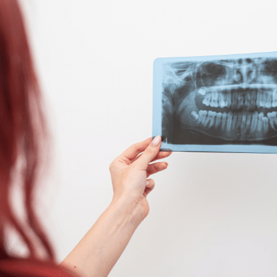 Second opinions 7 Woman holding up dental x ray