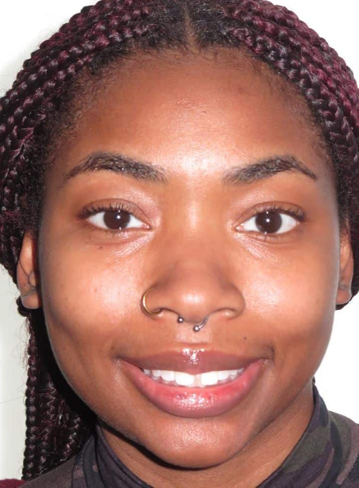 More smile transformations 46 Jfo smile gallery jaleah full face start