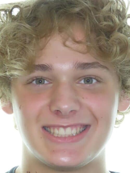 More smile transformations 37 Andrew smile final