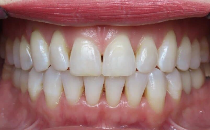 More smile transformations 31 Ellen center final