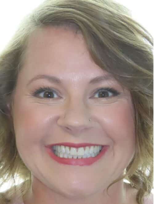 More smile transformations 29 Ellen smile final