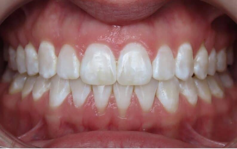 More smile transformations 25 Sela center final