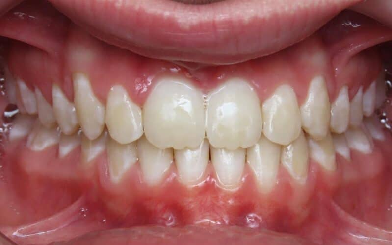 More smile transformations 23 Arlen center final