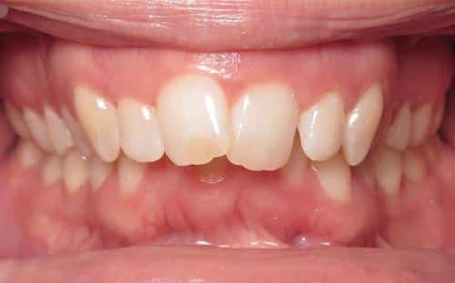 More smile transformations 16 Liz center start