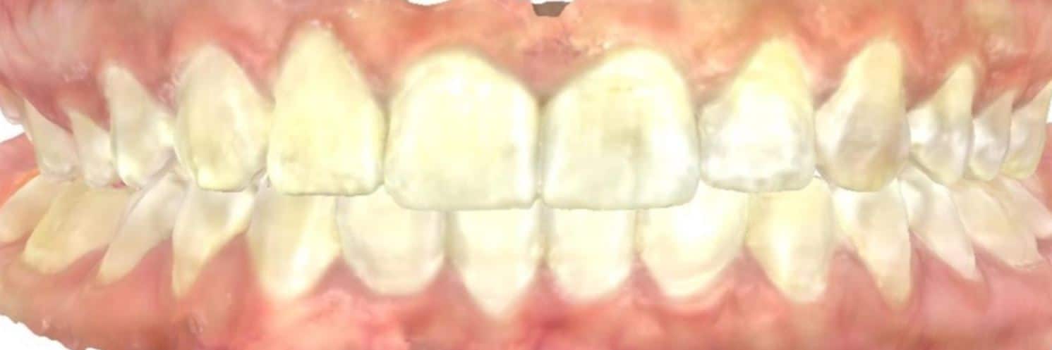 More smile transformations 11 Smile transformation after