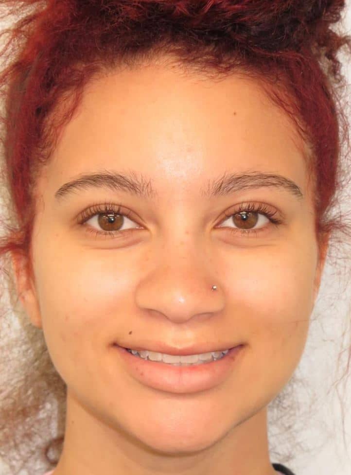 More smile transformations 13 Smile transformation final