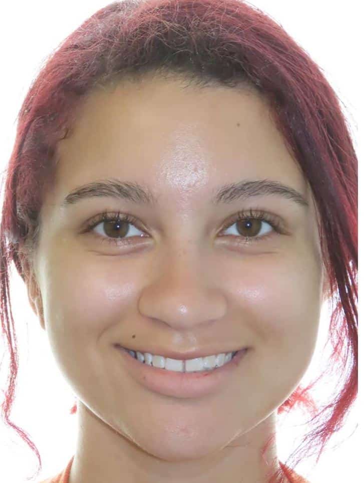 More smile transformations 12 Smile transformation before