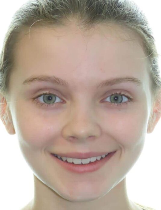 Smile gallery 233 Brooke b smile final