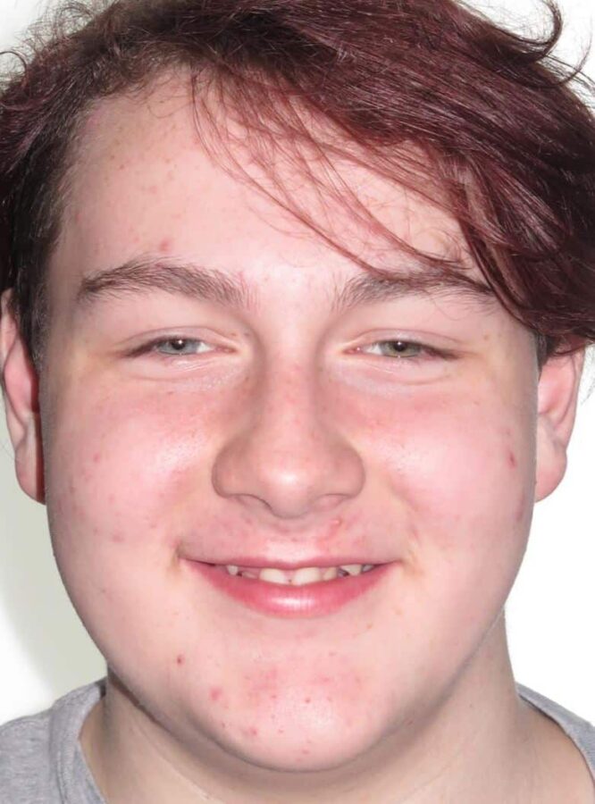 Smile gallery 230 Jack c 1 smile start
