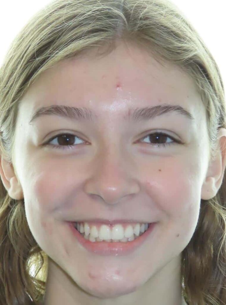 Smile gallery 239 Lucy t smile final