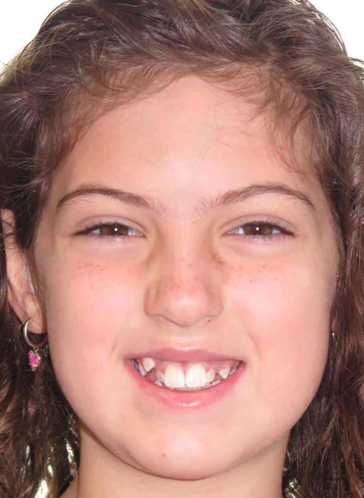 Smile gallery 198 Isla 1 smile start photo
