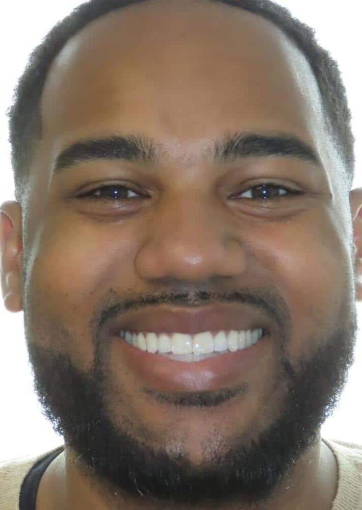 Smile gallery 189 Bryant smile final