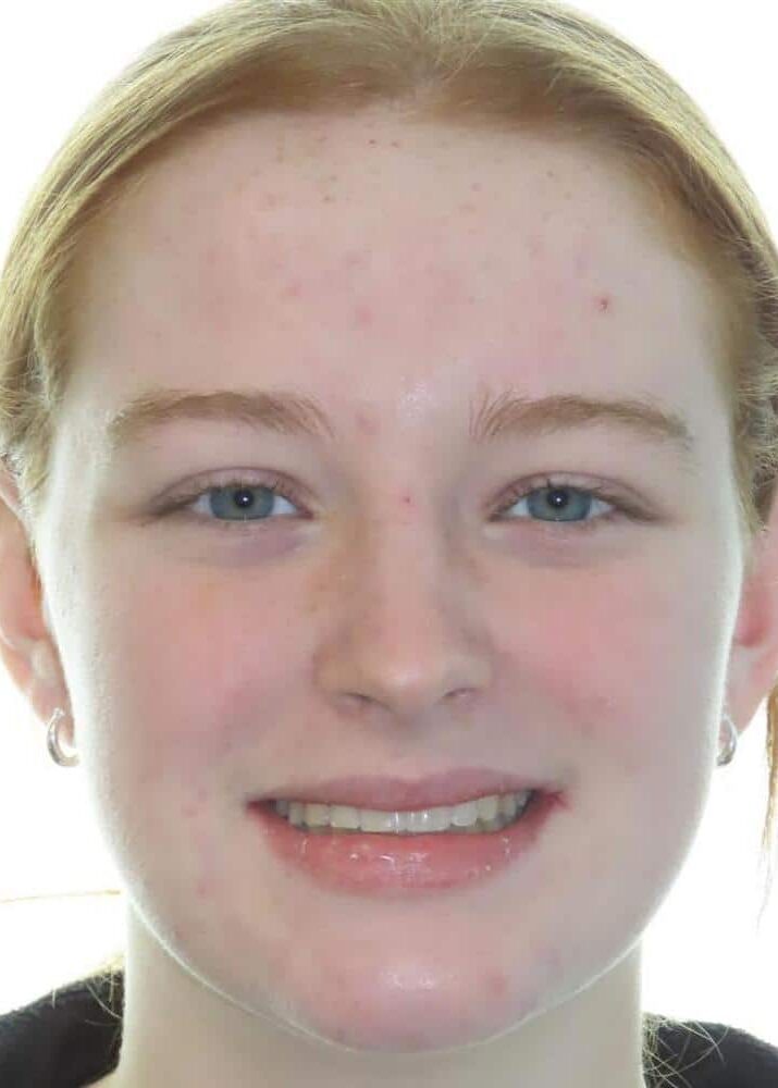 Smile gallery 191 Maggie smile final