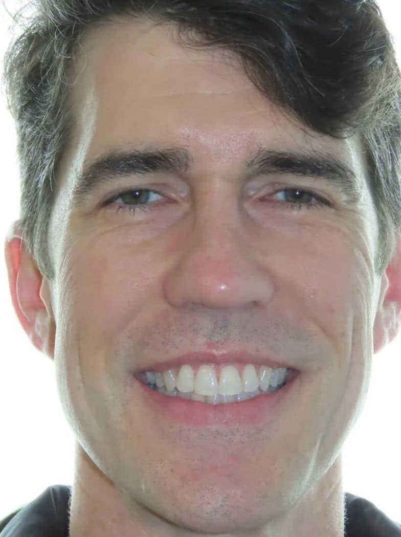 Smile gallery 167 Patient smiling new smile transformation orthodontic treatment results