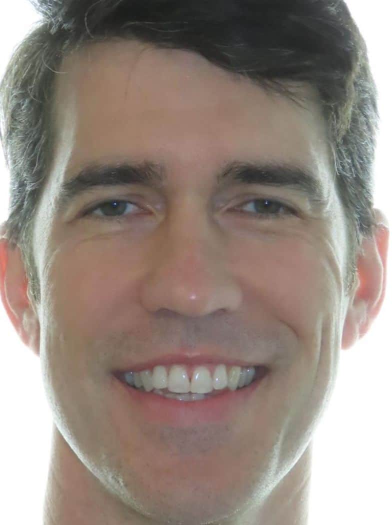 Smile gallery 166 Patient smiling before orthodontic treatment results
