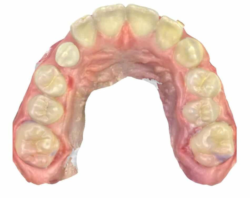 Smile gallery 161 Joosse patient occlusal after treatment