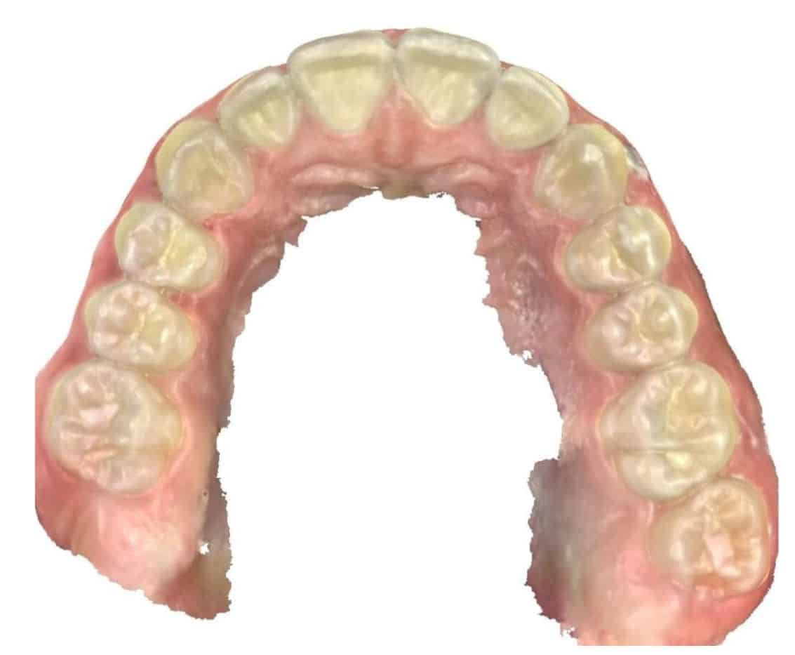 Smile gallery 153 Scan of teeth