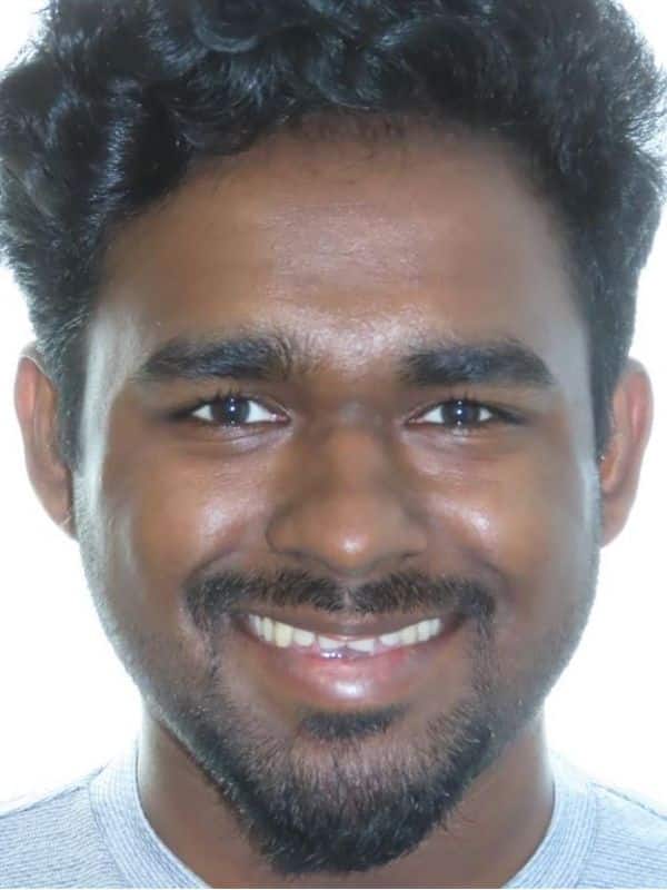 Smile gallery 138 Patient smile before treatment start