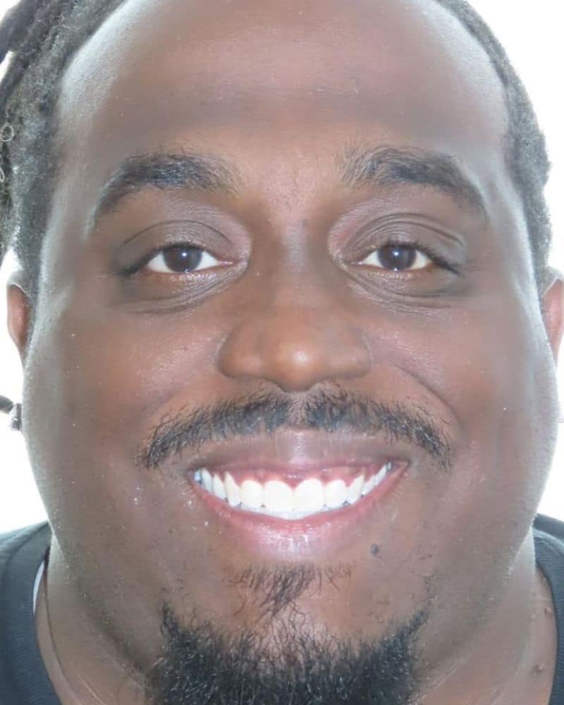 Smile gallery 125 A close up of a man smiling after orthodontic treatment