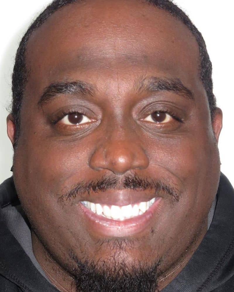 Smile gallery 124 A close-up of a man smiling before orthodontic treatment