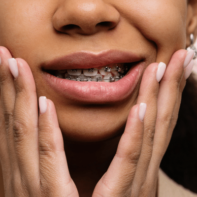 What to do in case of an orthodontic emergency 2 Person holding their cheeks in uncertainty and pain, representing orthodontic emergency