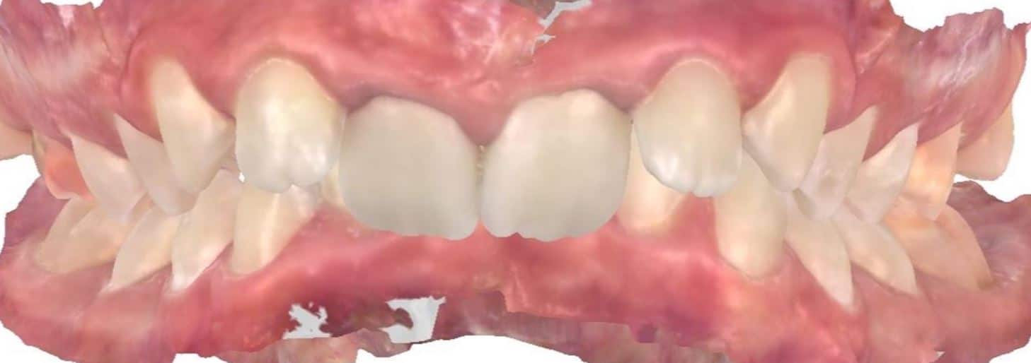 Smile gallery 68 Claire teeth before