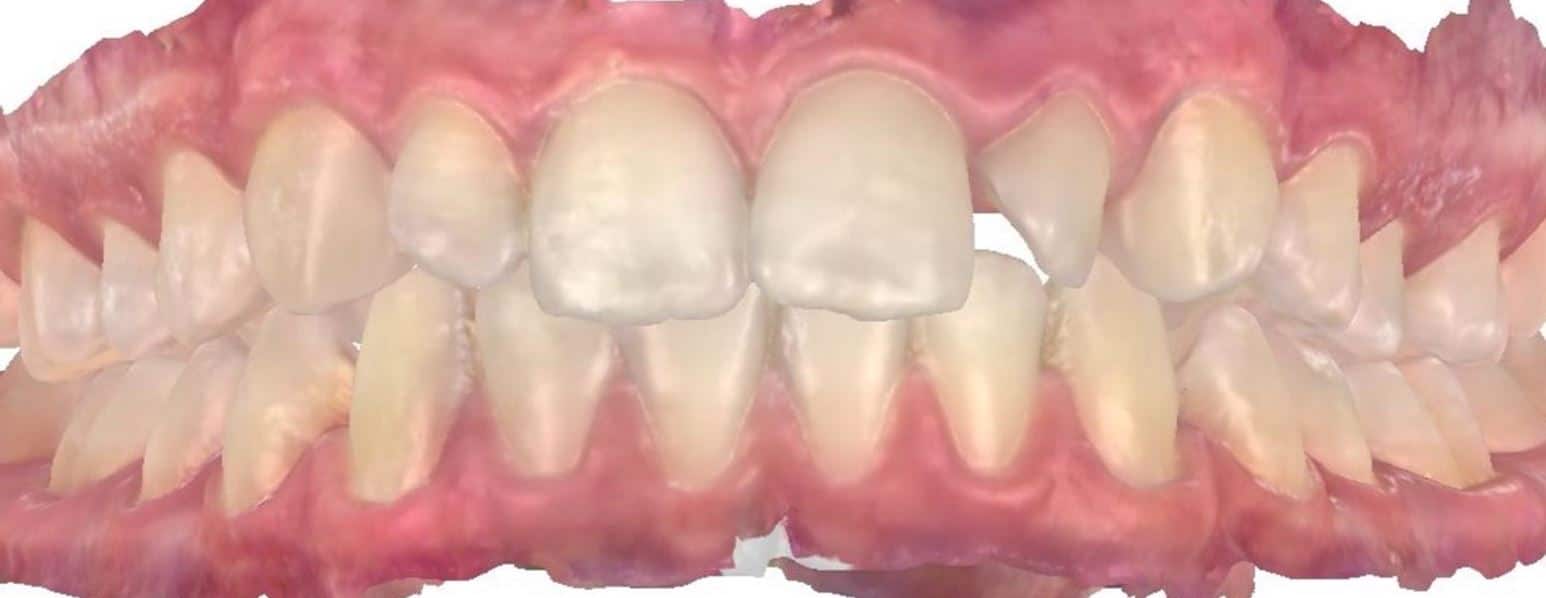 Smile gallery 66 Landon teeth close up