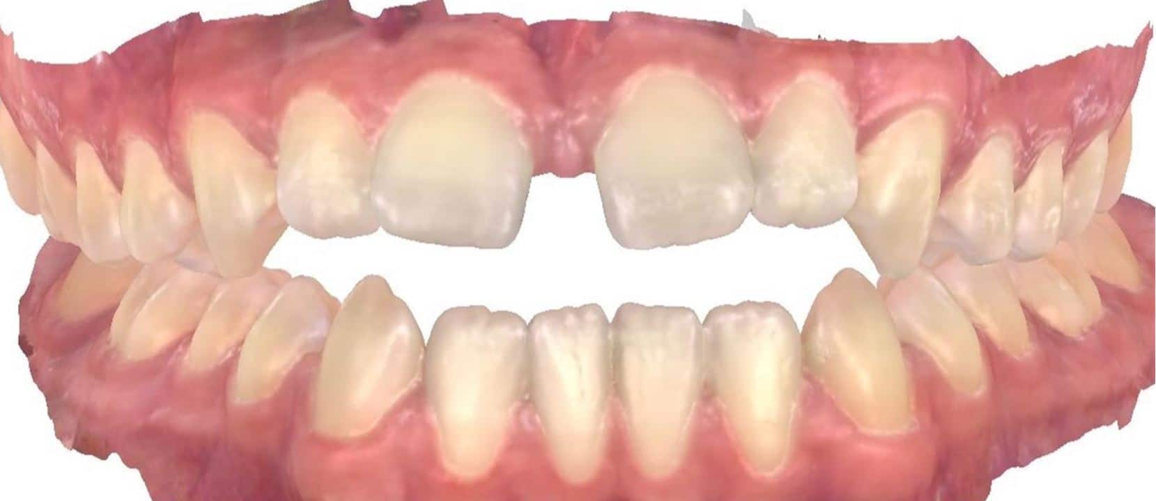 Smile gallery 36 Ryan beginning scan