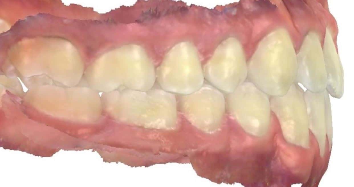Smile gallery 39 Ryan side scan final