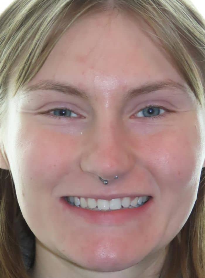 Smile gallery 19 Samantha g smile final