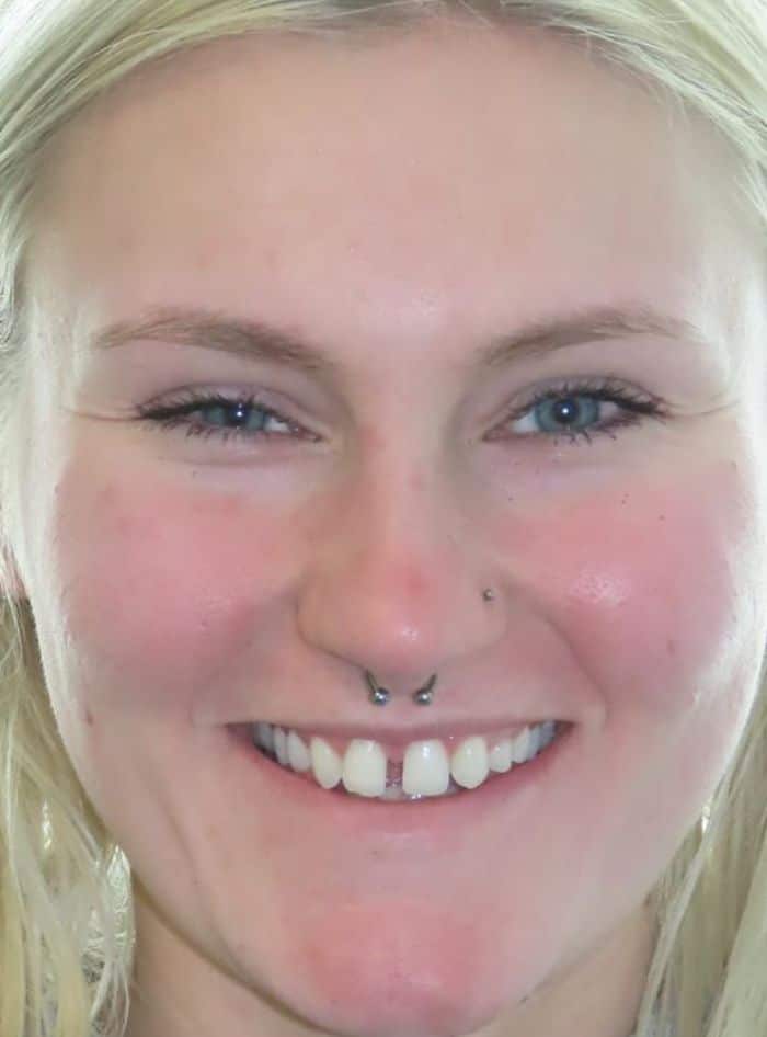 Smile gallery 18 Samantha g smile start