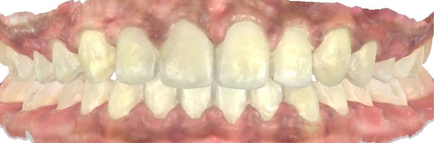 Smile gallery 13 Ella scan final