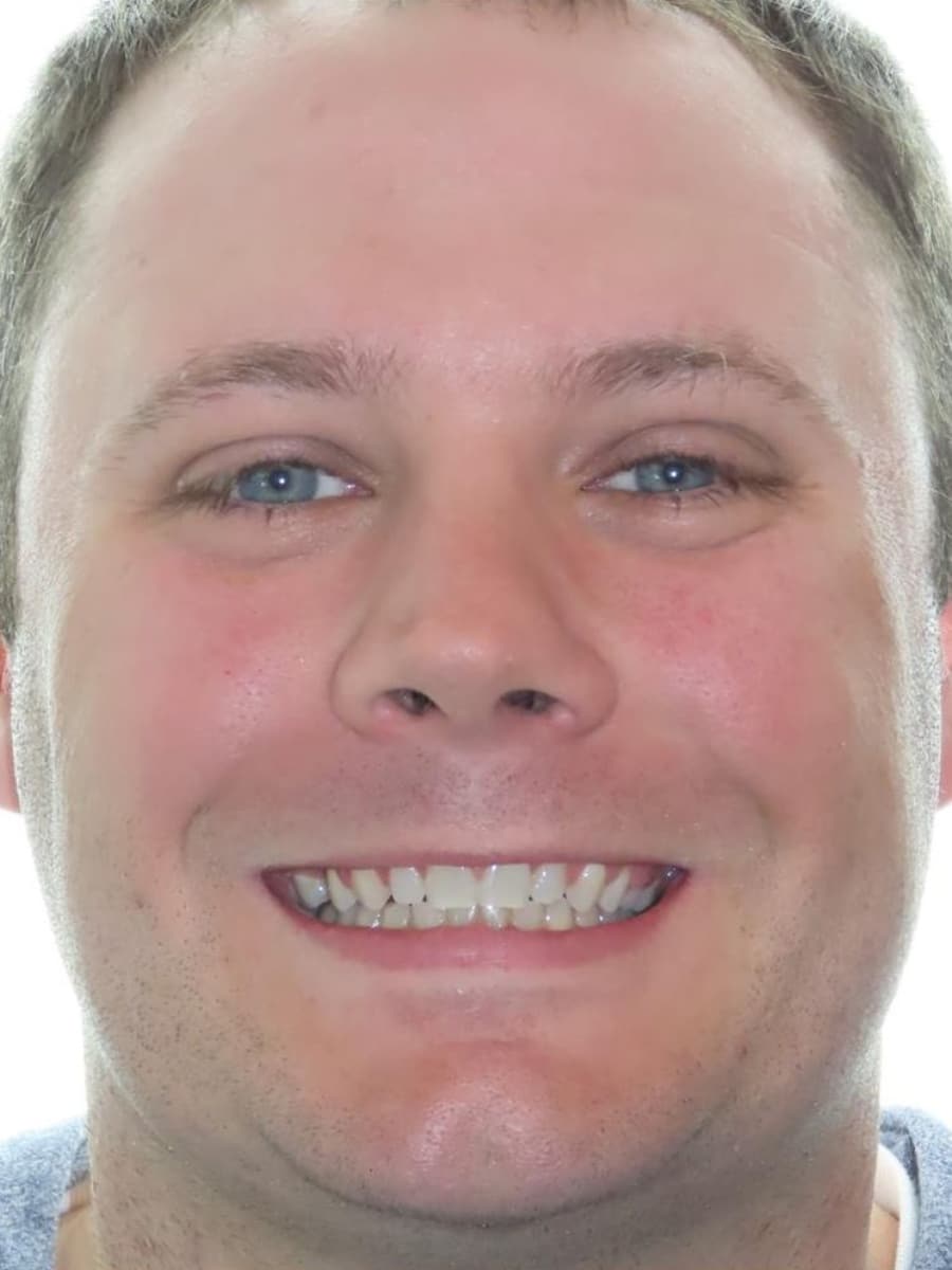 Smile gallery 17 Stephen final